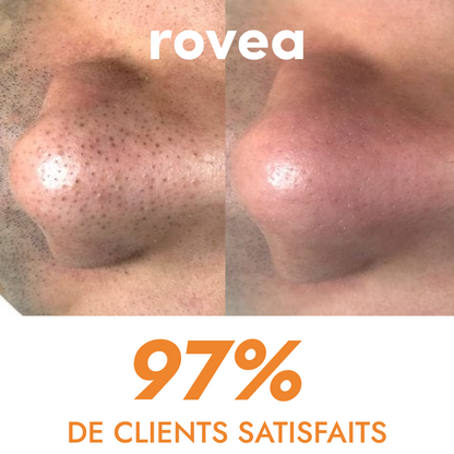 Pore ​​reducing serum